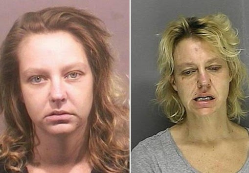 Σοκαριστικές φωτογραφίες ανθρώπων πριν και μετά την χρήση ναρκωτικών ουσιών [photos] - Φωτογραφία 8