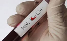 «Ρίζωσε» ο κοινωνικός στιγματισμός για τον HIV - Φωτογραφία 1