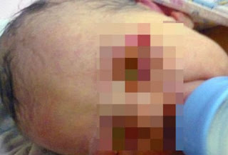 Εικόνες που σοκάρουν: Βρέθηκε νεογέννητο μέσα σε δάσος, σκεπασμένο από έντομα! [photo] - Φωτογραφία 1
