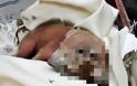 ΣΟΚΑΡΙΣΤΙΚΟ: Γεννήθηκε γουρουνάκι με δύο κεφάλια! [photo]