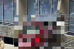 70χρονος «κατάφερε» ένα εξαιρετικά σπάνιο τροχαίο ατύχημα - Αν δείτε τις εικόνες θα μείνετε... [photos]