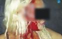 Χαμός στην Ρόδο - Σοκάρει η εικόνα της γυναίκας που δέχτηκε άγρια επίθεση σε ΑΤΜ τράπεζας [photo] - Φωτογραφία 2