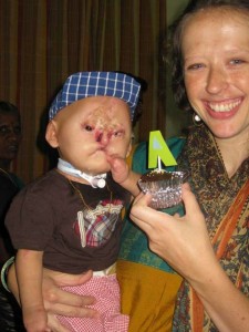 Συγκλονίζει η ιστορία του μωρού χωρίς πρόσωπο... [photos] - Φωτογραφία 6