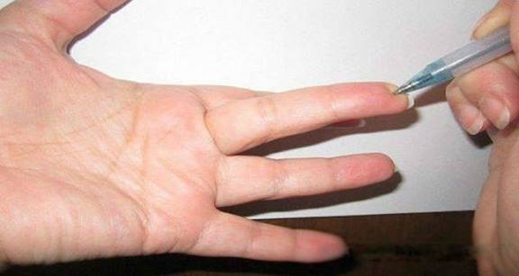 Δείτε το σημείο στο δάχτυλο που μειώνει την πίεση και εξαφανίζει κάθε είδους πόνο - Φωτογραφία 2