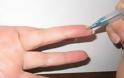 Δείτε το σημείο στο δάχτυλο που μειώνει την πίεση και εξαφανίζει κάθε είδους πόνο - Φωτογραφία 1