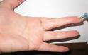 Δείτε το σημείο στο δάχτυλο που μειώνει την πίεση και εξαφανίζει κάθε είδους πόνο - Φωτογραφία 2