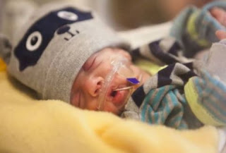 ΚΑΤΑΠΛΗΚΤΙΚΟ ΒΙΝΤΕΟ: Το μωράκι που γεννήθηκε πρόωρα, ζύγιζε μόλις 538 γραμμάρια αλλά τελικά τα κατάφερε [video] - Φωτογραφία 1