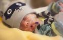ΚΑΤΑΠΛΗΚΤΙΚΟ ΒΙΝΤΕΟ: Το μωράκι που γεννήθηκε πρόωρα, ζύγιζε μόλις 538 γραμμάρια αλλά τελικά τα κατάφερε [video]