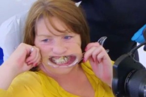 Απίστευτη εικόνα - Είχε 10 χρόνια να επισκεφτεί τον οδοντίατρο της... - Φωτογραφία 3
