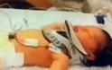 Νοσοκόμα αποκοιμήθηκε και το νεογέννητο της έπεσε από τα χέρια!