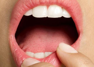Oδηγίες για τη φροντίδα του στόματος - Φωτογραφία 1
