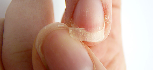 Ξέρετε τι μαρτυρούν τα νύχια για την κατάσταση της υγείας σας; [photo] - Φωτογραφία 2
