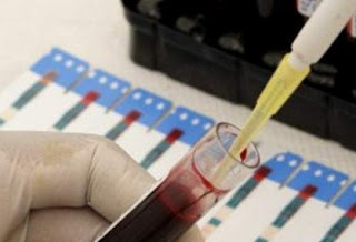 Πρωτοποριακό τεστ αίματος προβλέπει την επανεμφάνιση του καρκίνου του μαστού - Φωτογραφία 1