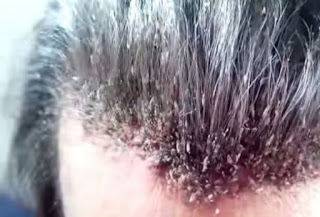 ΑΗΔΙΑ: Μετά από αυτό θα λούζεις τα μαλλιά σου 5 φορές την ημέρα [video] - Φωτογραφία 1