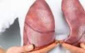 Καρκίνος του πνεύμονα: Αυτές είναι οι πρώτες ενδείξεις
