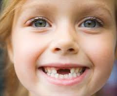 Το χρόνιο στρες της μητέρας αυξάνει τα χαλασμένα δόντια στα παιδιά - Φωτογραφία 1