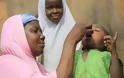 ΠΟΥ: Δεν είναι πλέον ενδημική η πολιομυελίτιδα στη Νιγηρία