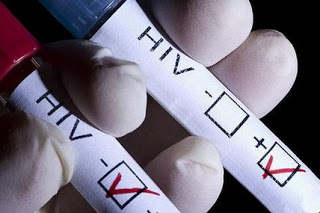 Ανακαλύφθηκε το τρωτό σημείο του HIV - O Έλληνας που συμμετείχε στις μελέτες - Φωτογραφία 1