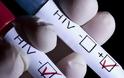 Ανακαλύφθηκε το τρωτό σημείο του HIV - O Έλληνας που συμμετείχε στις μελέτες