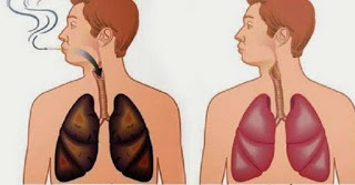 Αυτό το ξέρατε; Υπάρχουν τροφές που καθαρίζουν τα πνευμόνια σας - Φωτογραφία 1