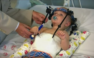 Ιατρικό θαύμα: Ξανά-συνέδεσαν με την σπονδυλική στήλη το κεφάλι μωρού - Φωτογραφία 1