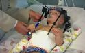 Ιατρικό θαύμα: Ξανά-συνέδεσαν με την σπονδυλική στήλη το κεφάλι μωρού
