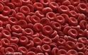 Αληθής πολυκυτταραιμία: Οι σοβαρές επιπλοκές της σπάνιας αιματολογικής κακοήθειας