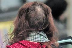 Αγνώριστη πασίγνωστη ηθοποιός - Με αραιωμένα μαλλιά και... ρίζα στους δρόμους!