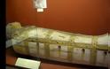 ΑΝΑΚΑΛΥΨΗ ΒΟΜΒΑ επιστημόνων σε μουμιοποιημένο σώμα Αιγύπτιου ιερέα: Του είχαν τοποθετήσει χειρουργικά μεταλλικό εμφύτευμα στο πόδι πριν από 2.600 χρόνια… [video]