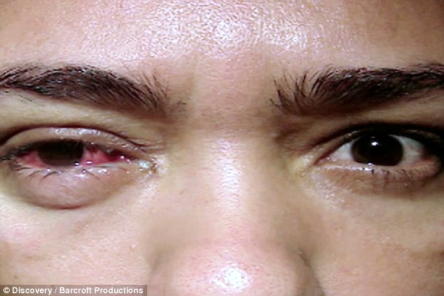 ΑΠΙΣΤΕΥΤΟ: Η Βραζιλιάνα με τα κρυστάλλινα δάκρυα - Μια σπάνια ασθένεια [photos] - Φωτογραφία 2