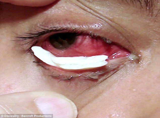 ΑΠΙΣΤΕΥΤΟ: Η Βραζιλιάνα με τα κρυστάλλινα δάκρυα - Μια σπάνια ασθένεια [photos] - Φωτογραφία 3