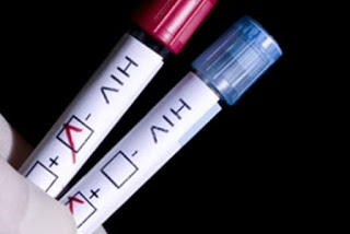 Φάρμακο κατά του αλκοολισμού «ξετρυπώνει» τον κρυμμένο στα κύτταρα ιό HIV του AIDS - Φωτογραφία 1