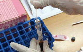 Δωρεάν εξετάσεις για HIV και για τις ηπατίτιδες B και C από σήμερα σε Θεσσαλονίκη και Αθήνα - Φωτογραφία 1