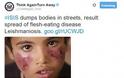 ΠΑΓΚΟΣΜΙΟΣ ΣΥΝΑΓΕΡΜΟΣ! Φρίκη χωρίς όριο από το Ισλαμικό Κράτος: Τώρα σπέρνει ιό που... τρώει τη σάρκα! [photo] - Φωτογραφία 2