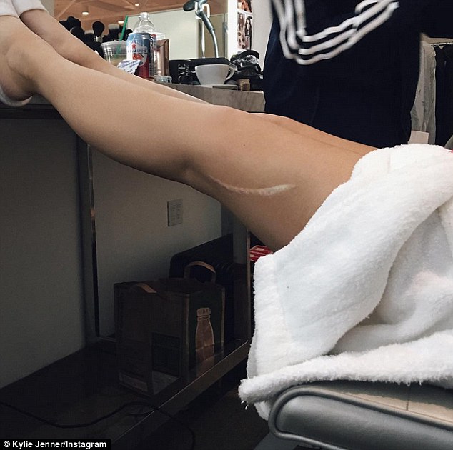 Το σημάδι της Kylie Jenner που άφησε άφωνο το Instagram... [photo] - Φωτογραφία 2