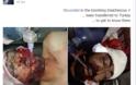 Εκατόμβη νεκρών ισλαμιστών σε Λαττάκεια και Χαλέπι - Επέλαση του συριακού Στρατού σε όλα τα μέτωπα [ΠΡΟΣΟΧΗ ΣΚΛΗΡΕΣ ΕΙΚΟΝΕΣ] - Φωτογραφία 29