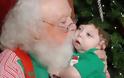 Το μωράκι που γεννήθηκε χωρίς εγκέφαλο γιορτάζει τα Χριστούγεννα