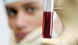 1 τεστ αίματος μια φορά τον χρόνο μπορεί να σας σώσει από καρκίνο των ωοθηκών - Φωτογραφία 1