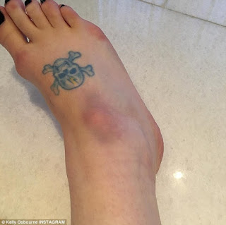 Σε ποια διάσημη ανήκει αυτό το τραυματισμένο πόδι; [photo] - Φωτογραφία 2