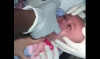Το μωρό της δεν μπορούσε να αναπνεύσει - Όταν πήγε στο Νοσοκομείο, δείτε τι έβγαλαν από το Λαιμό του [photo] - Φωτογραφία 1