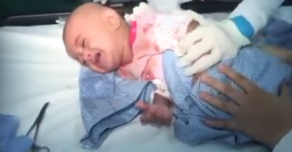 Το μωρό της δεν μπορούσε να αναπνεύσει - Όταν πήγε στο Νοσοκομείο, δείτε τι έβγαλαν από το Λαιμό του [photo] - Φωτογραφία 4