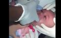 Το μωρό της δεν μπορούσε να αναπνεύσει - Όταν πήγε στο Νοσοκομείο, δείτε τι έβγαλαν από το Λαιμό του [photo]