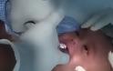 Το μωρό της δεν μπορούσε να αναπνεύσει - Όταν πήγε στο Νοσοκομείο, δείτε τι έβγαλαν από το Λαιμό του [photo] - Φωτογραφία 2