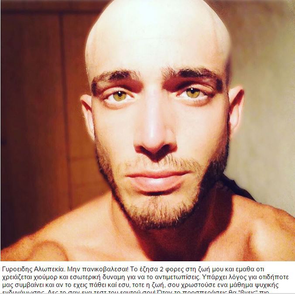 Θεοχάρης Ιωαννίδης: «Η πρώτη φορά που έχασα τα μαλλιά μου ήταν σοκ!» - Φωτογραφία 2