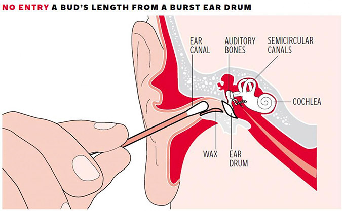 Γιατί ο καθαρισμός των αυτιών με μπατονέτες είναι μία πολύ επικίνδυνη συνήθεια; - Φωτογραφία 2