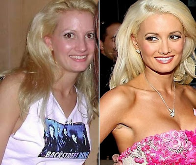 15 διάσημες πριν και μετά το χειρουργείο! - Φωτογραφία 12