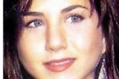 15 διάσημες πριν και μετά το χειρουργείο!