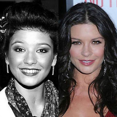 15 διάσημες πριν και μετά το χειρουργείο! - Φωτογραφία 2