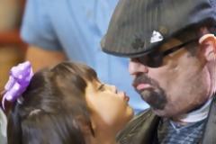 Η πρώτη επιτυχής μεταμόσχευση προσώπου (Photos)