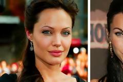 Οι πιο πετυχημένες πλαστικές του Χόλιγουντ